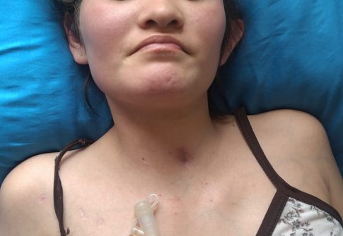 Ayuda a Ilsa Katherine Garzón Alfonzo